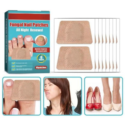 PARCHES ANTIHONGOS PARA UÑAS - ¡Mejora su apariencia en solo días!